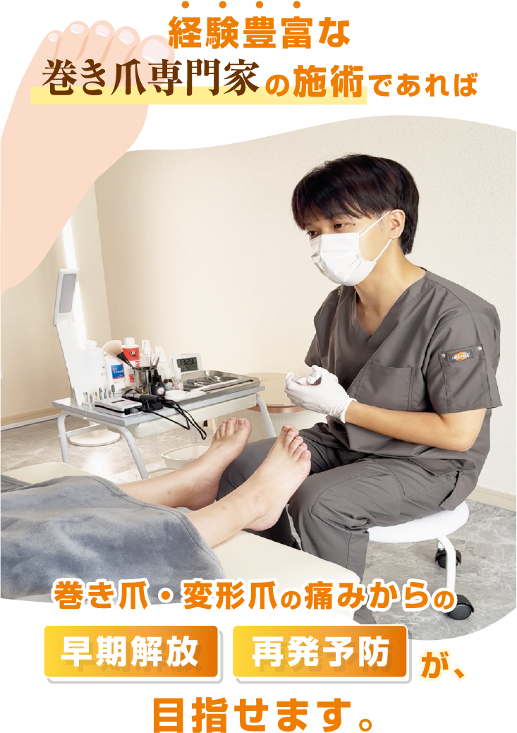 経験豊富な巻き爪専門家の施術であれば、巻き爪・変形爪からの早期解放・再発予防が目指せます。